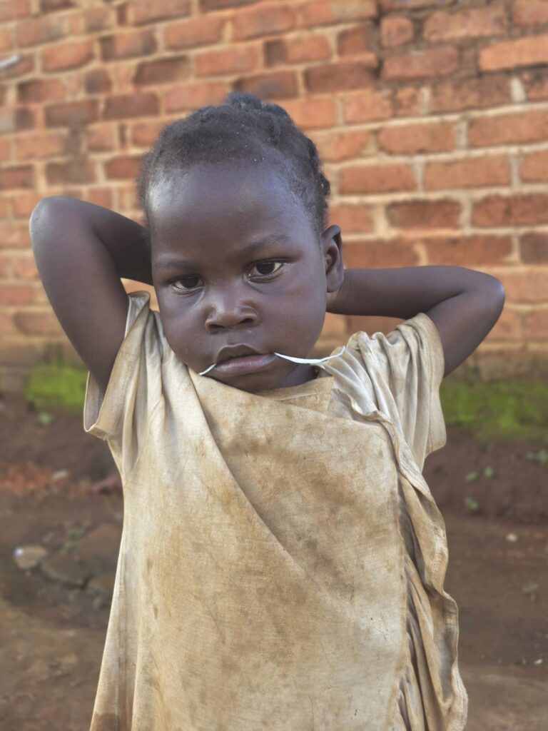 A malnourished child in ragged clothing in Congo